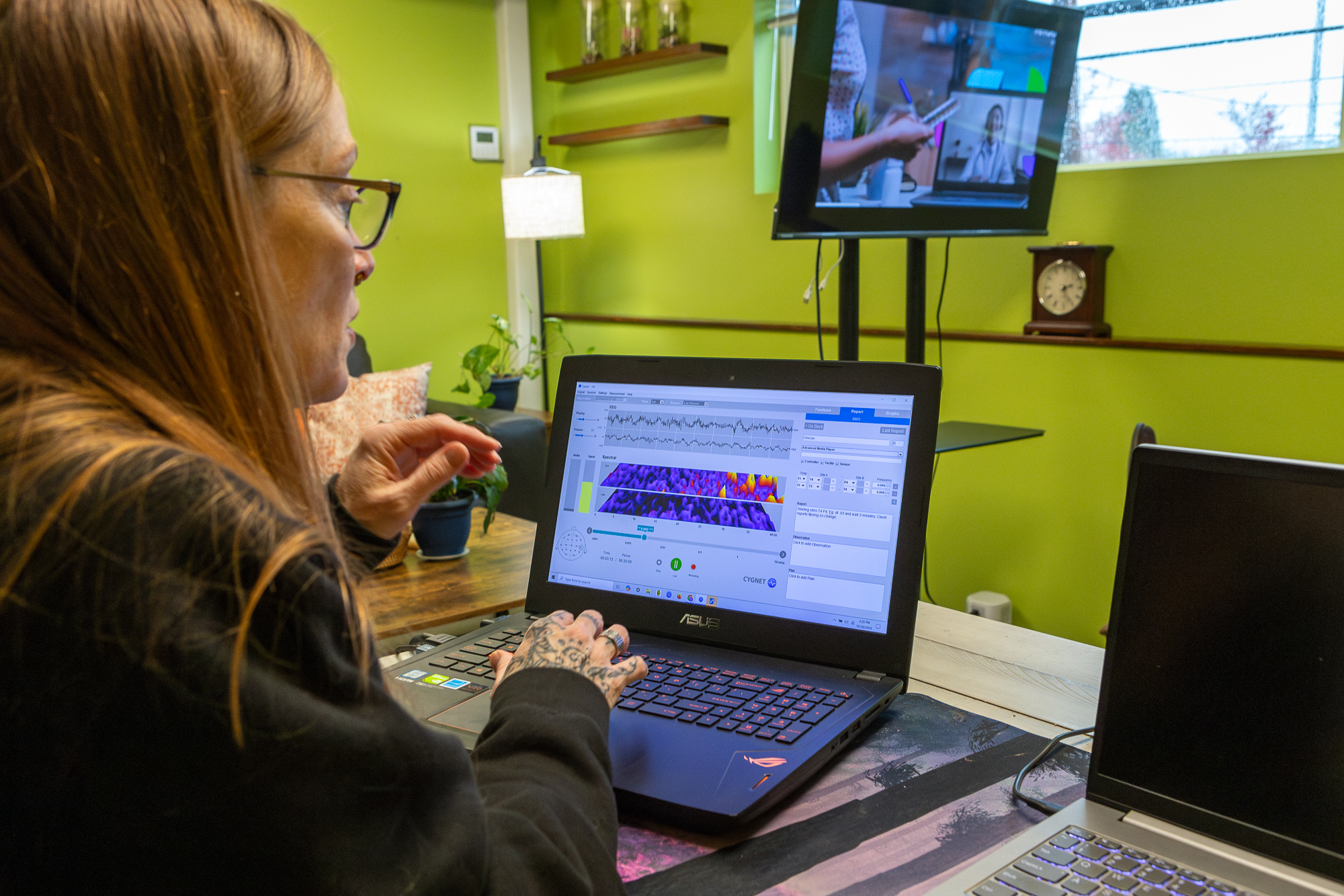 Neurofeedback Treatment